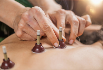 A close-up of cupping therapy being performed on a person's back. The therapist is placing the cups onto the skin, with steam rising from them, indicating the use of heated cups.